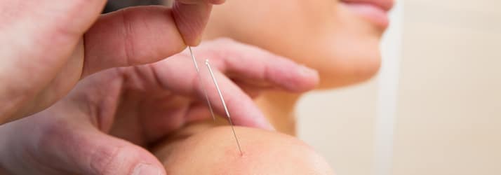 Chiropractic Littleton CO acupuncture